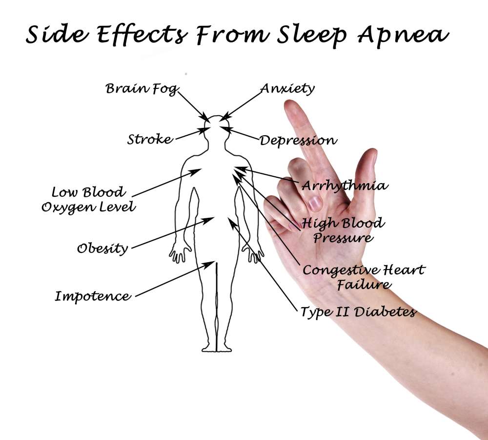 SLEEP APNEA: DON’T SLEEP ON IT!